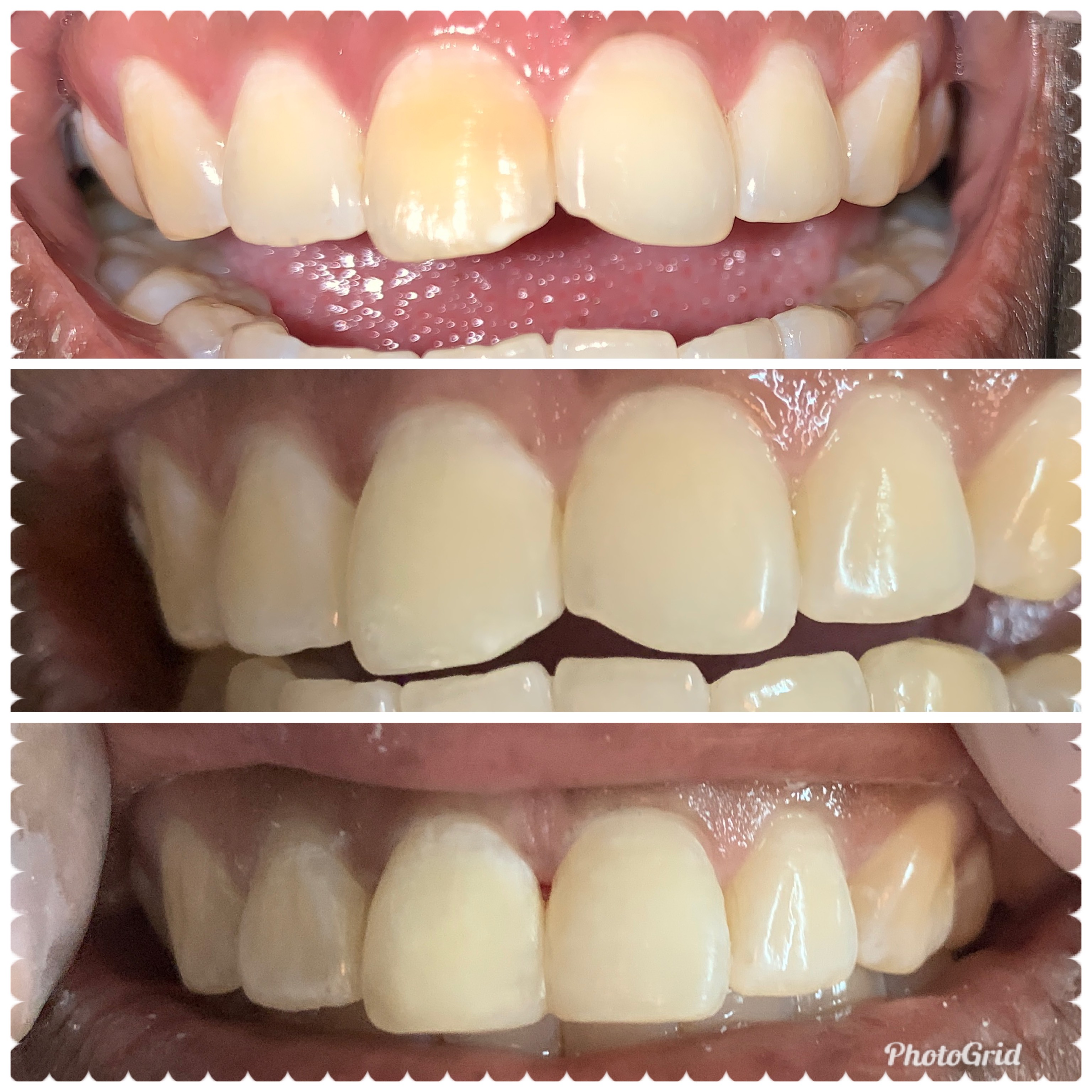 Smile Smart Dental Care photo 6