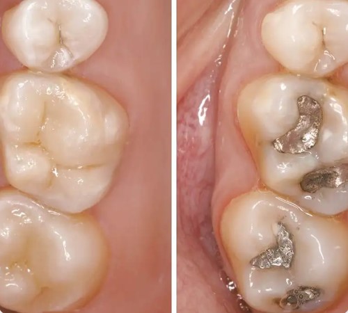 Coverley Dental Clinic photo 2