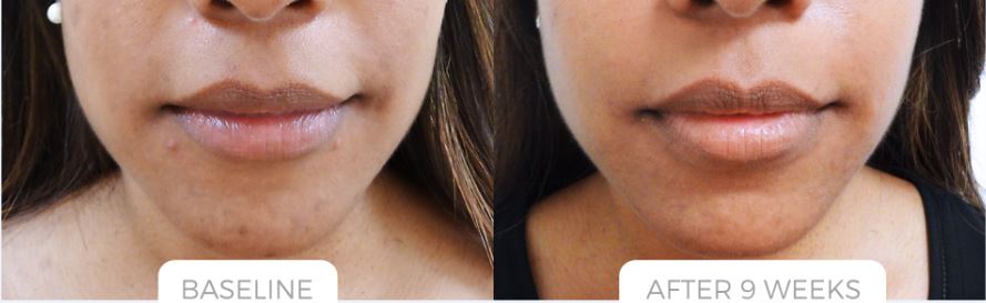 Sherrie's Electrolysis & Laser Skin Care photo 4