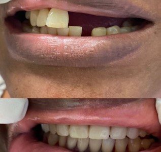 Easy Dental Care photo 8