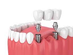 Palomos Dental Center photo 6