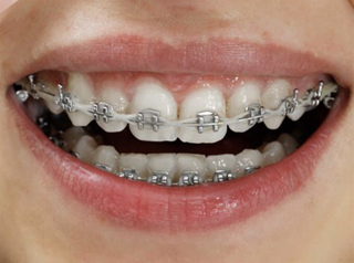 Diamante Dental photo 6