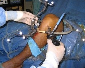 Orthoplex photo 1
