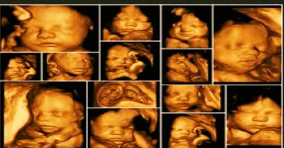 Goshen Medical Imaging photo 3