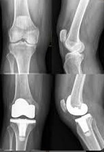 Orthoplex photo 2