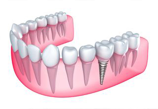 Goodwill Dental Cen photo 5