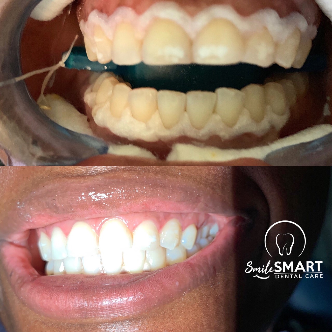 Smile Smart Dental Care photo 4