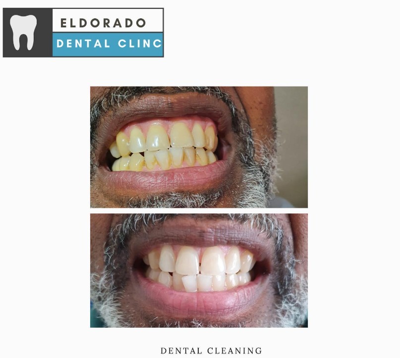 El Dorado Dental Clinic Limited photo 1