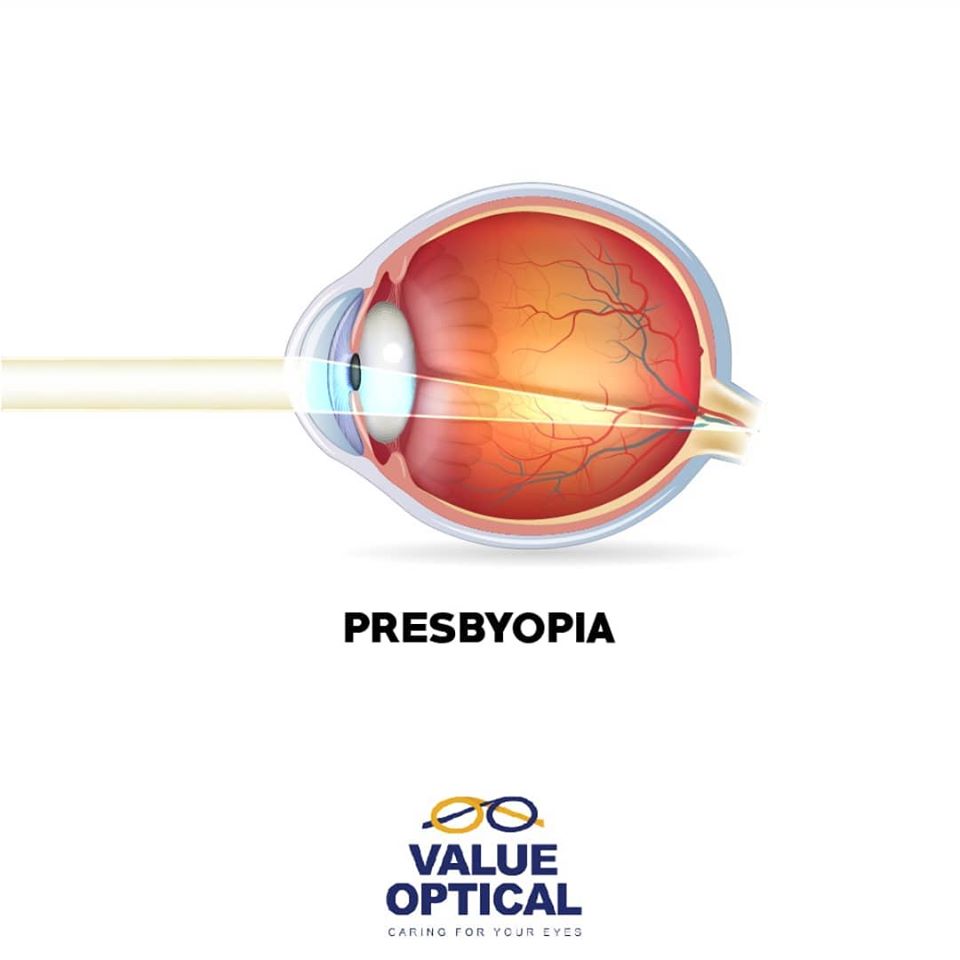 Value Optical Ltd photo 6