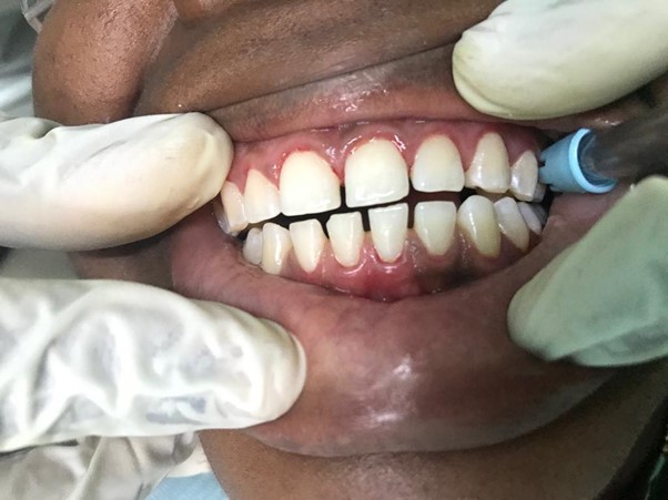 Embrace Dental photo 5
