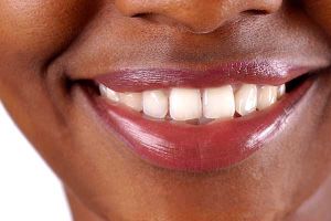 Oasis Dental photo 4