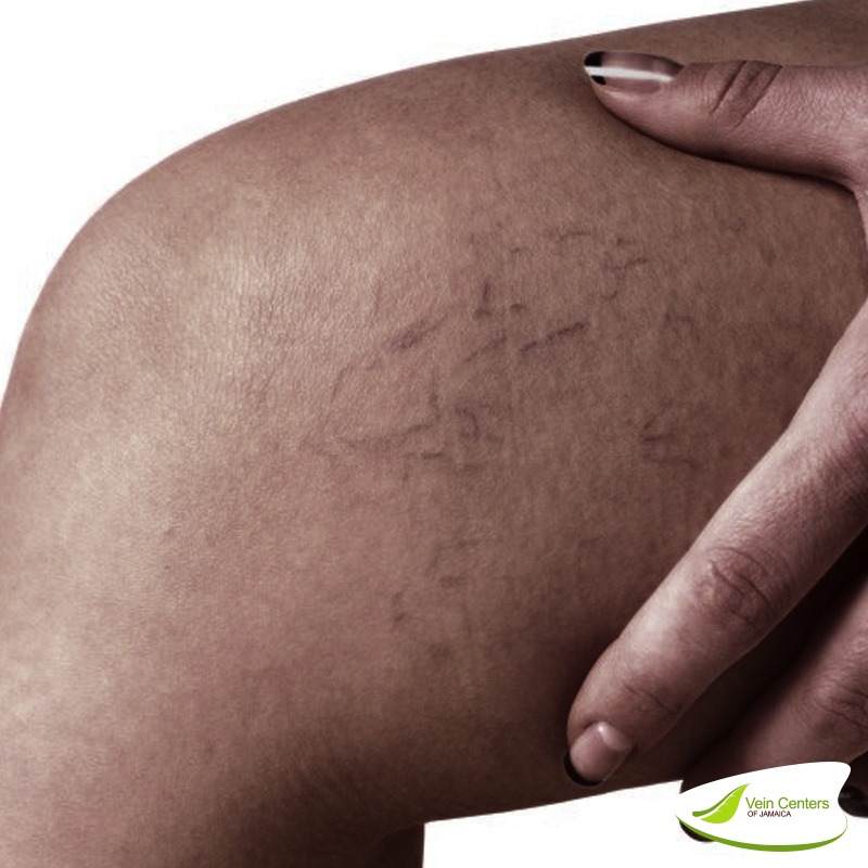 Vein Centers Of Jamaica photo 2