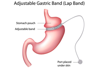Endo-Laparoscopic Surgi-Centre photo 4
