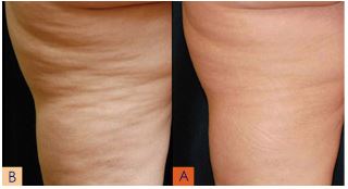 Sherrie's Electrolysis & Laser Skin Care photo 2