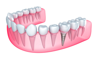 Chelsea Dental Centre photo 3