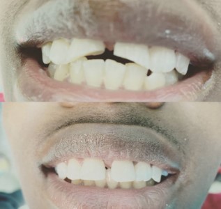 Easy Dental Care photo 3