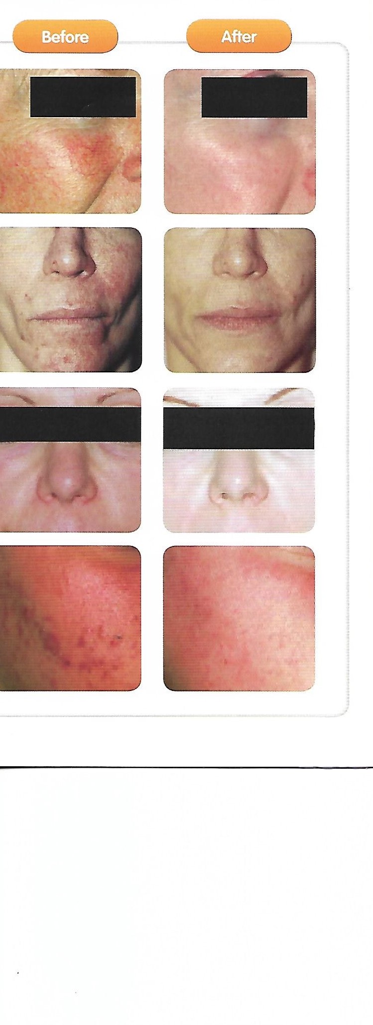 Sherrie's Electrolysis & Laser Skin Care photo 7