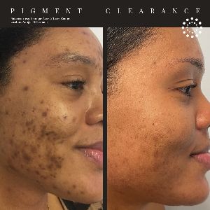 Dermalogics Aesthetic Dermatology photo 2