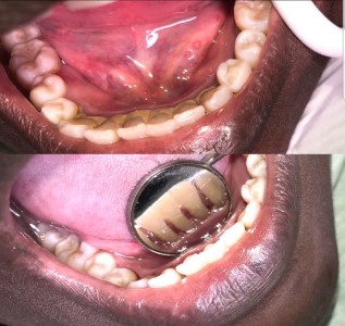 Easy Dental Care photo 13