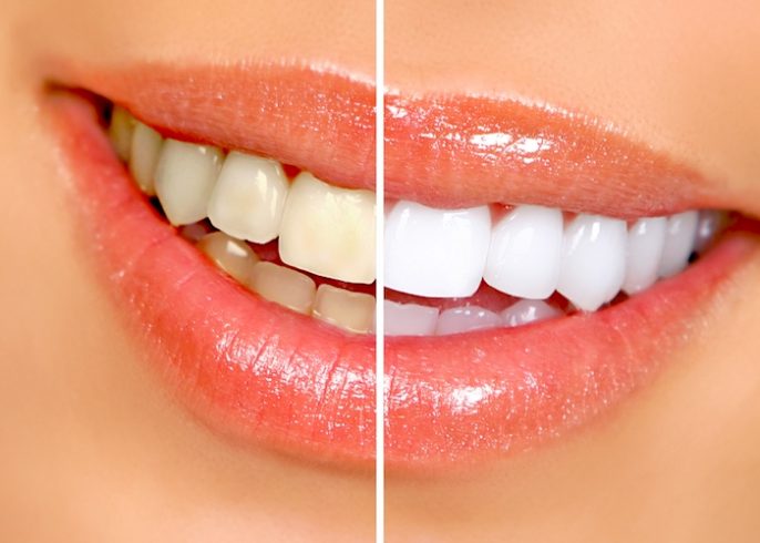 Tooth Perfect Dental Clinic And Lab Ltd photo 4