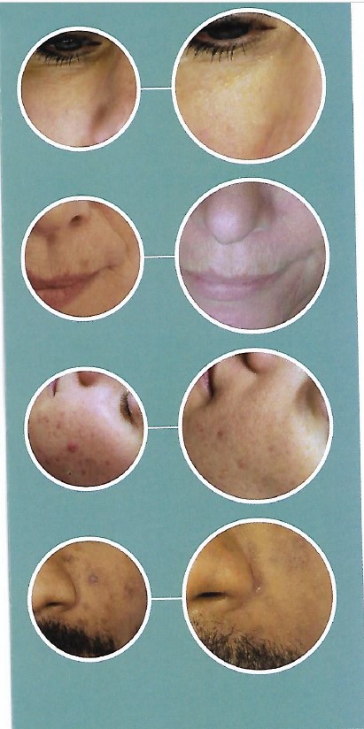 Sherrie's Electrolysis & Laser Skin Care photo 3