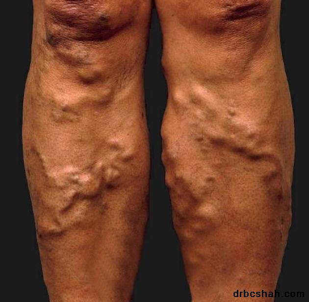 Vein Centers Of Jamaica photo 9