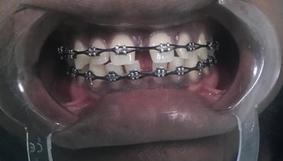 Embrace Dental photo 6