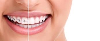 Palomos Dental Center photo 3