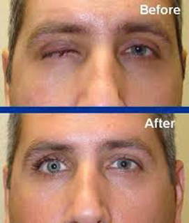 Precise Prosthetics Ltd photo 2