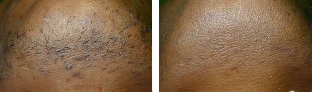 Sherrie's Electrolysis & Laser Skin Care photo 1